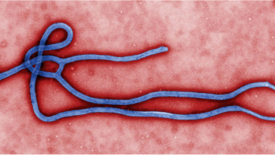 فيروس ايبولا- الأعراض والتشخيص والوقاية