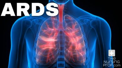 ماذا تعرف عن متلازمة الضائقة التنفسية الحادة ؟