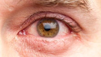 ما الذي يسبب عوامات العين؟