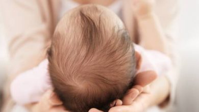 جفاف فروة الرأس عند الرضع